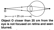 NCERT Solutions for Class 10 Science Chapter 11 Human Eye and Colourful World Chapter End Questions Q8